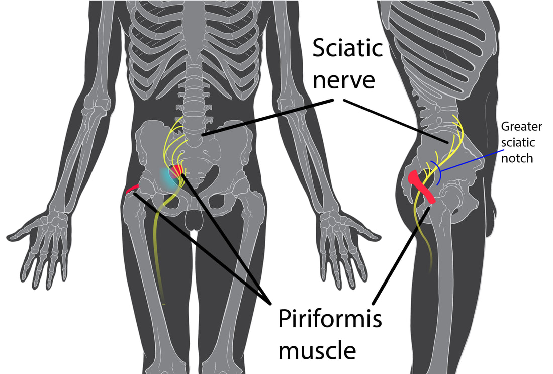 causes of sciatic nerve pain charlotte nc