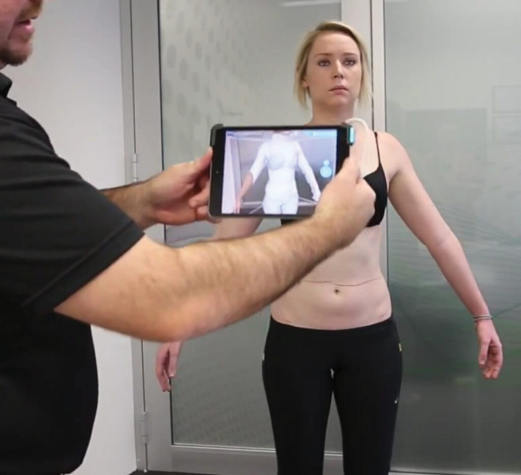 3d Scanning for scoliosis brace in Charlotte NC
