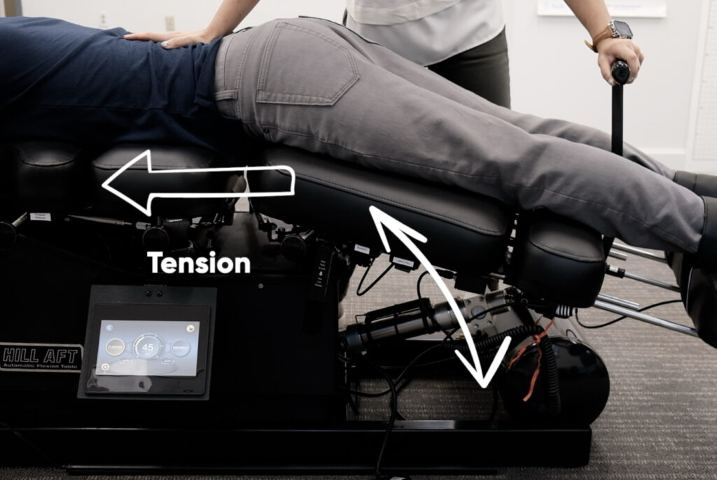 Flexion Distraction Therapy in Charlotte NC