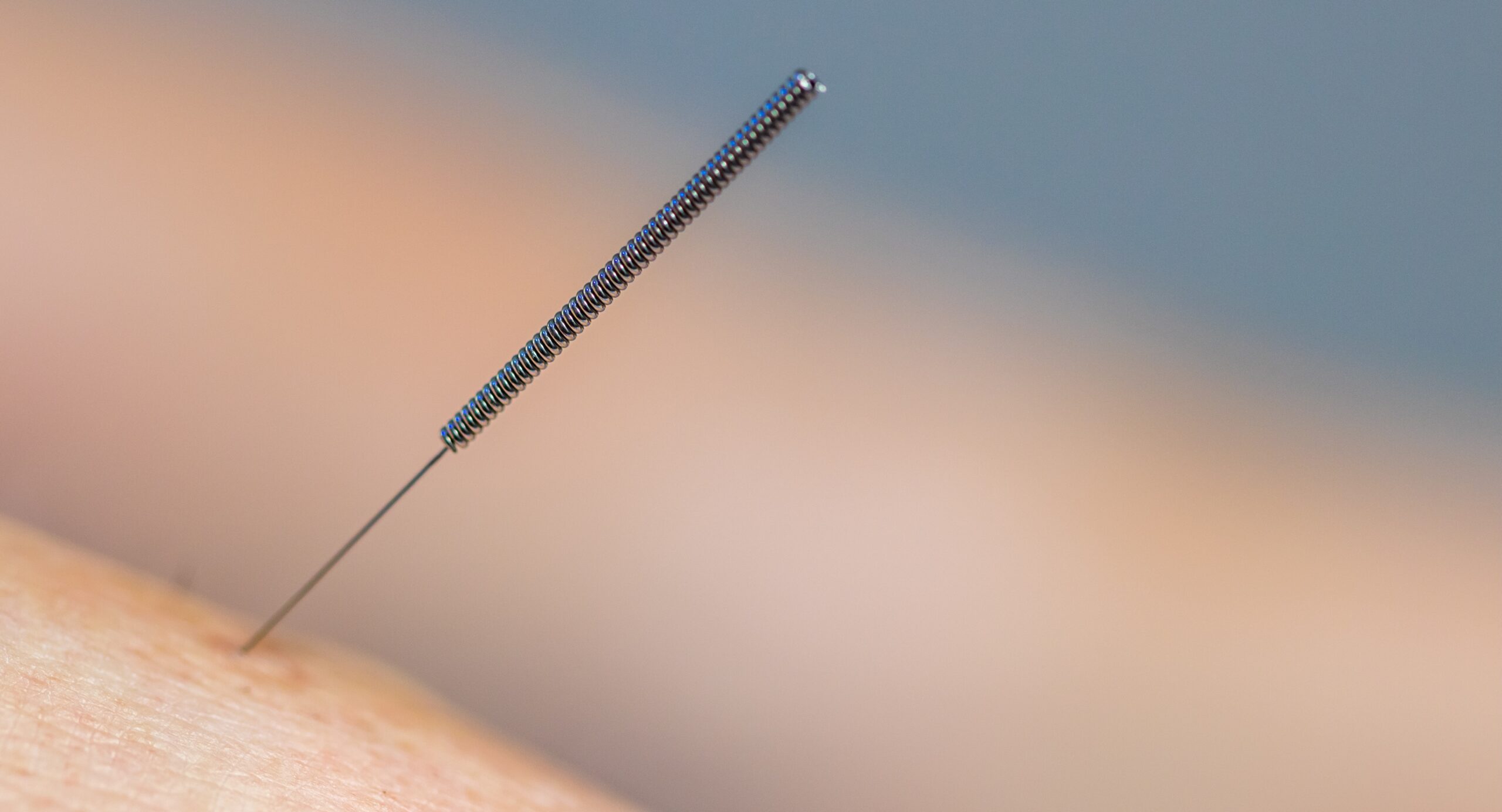 You are currently viewing Trigger Point Therapy vs Dry Needle Therapy vs Trigger Point Injections: Which Is Right for You?