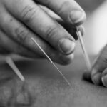 Read more about the article Dry Needle Therapy for Ankle Pain in Charlotte, NC