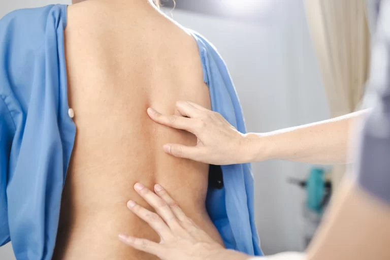 Read more about the article Understanding Scoliosis in Adults: What Causes It and How to Treat It