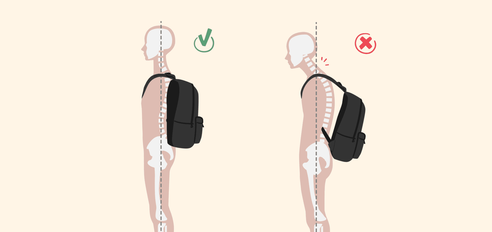 how a backpack should fit for someone with scoliosis